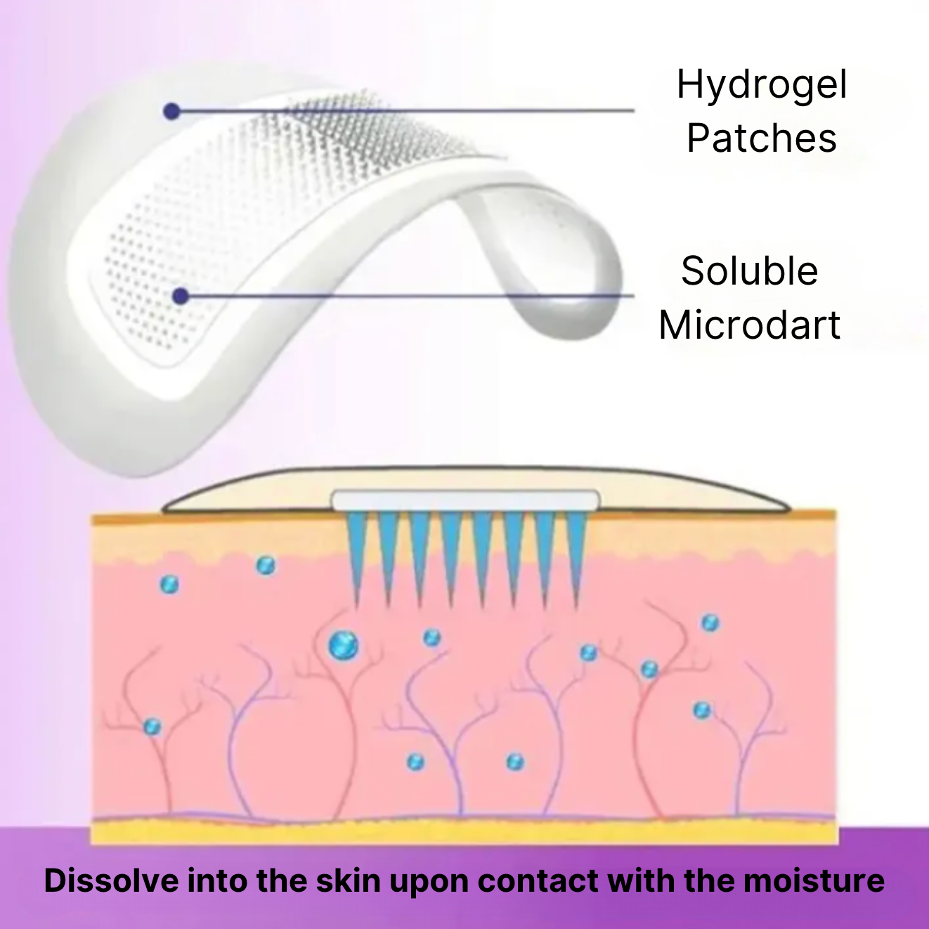 Microneedle EyePatches