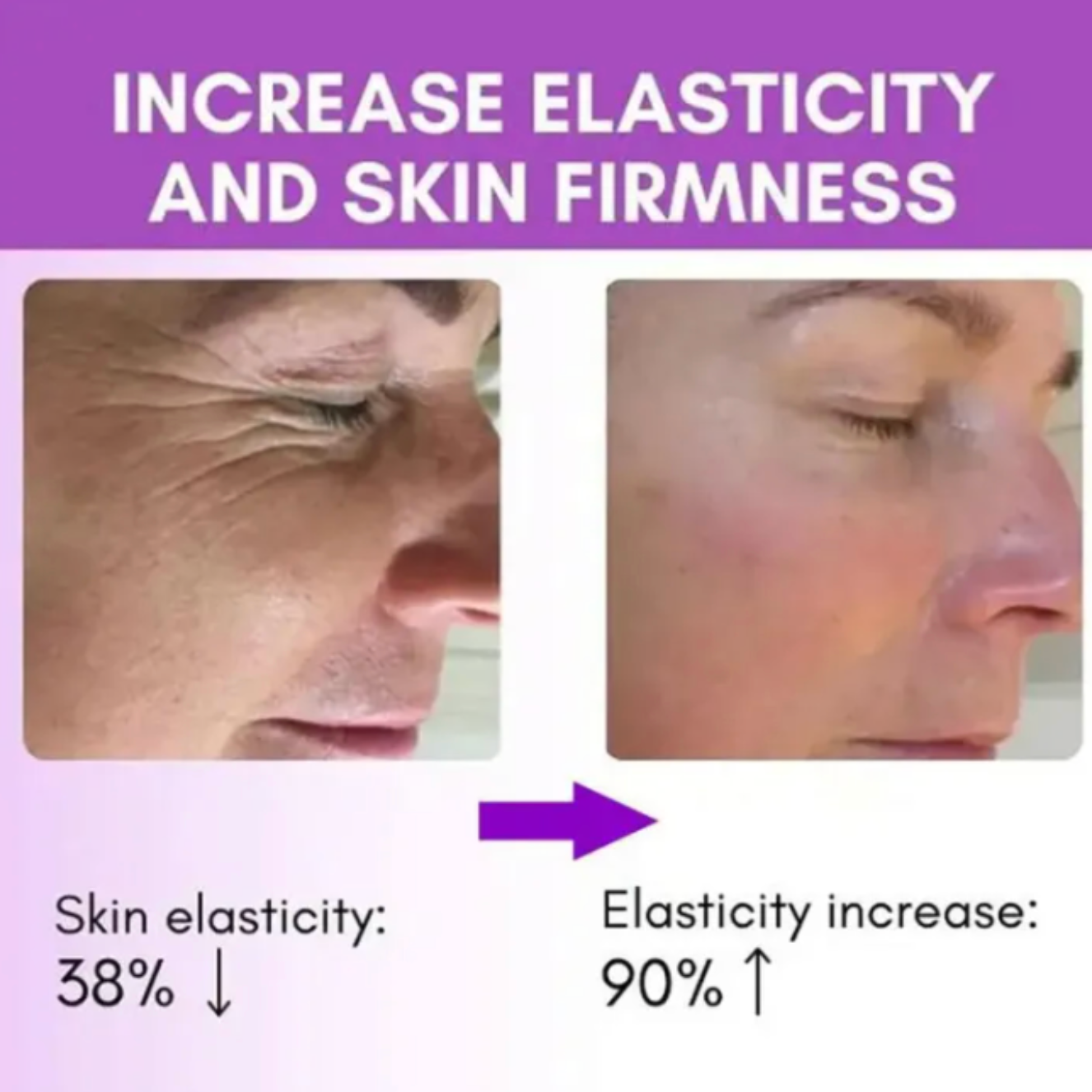 Microneedle EyePatches