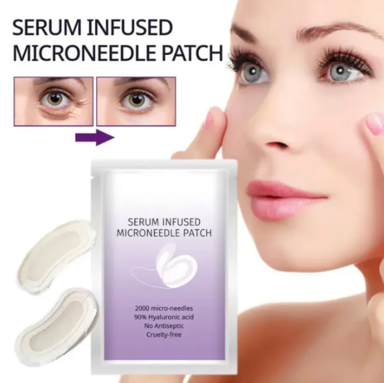 Microneedle EyePatches